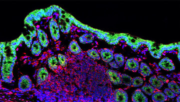 Kanvas Bioscience stock photo of microbiome
